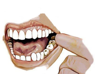 Ağıl dişi nə üçün təkamül nəzəriyyəsinə dəlil ola bilməz?